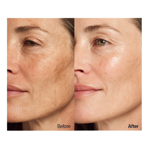 Deep Collagen Retinol Spicule Cream