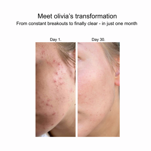 COPPER PEPTIDES SERUM